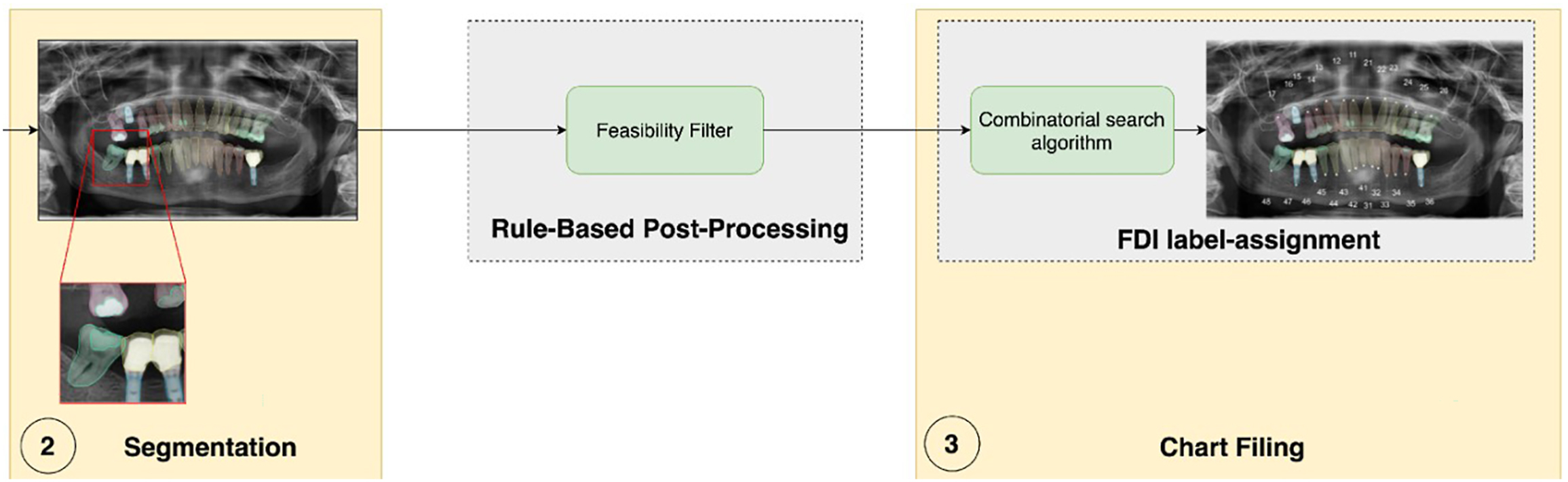 A diagram outlines the segmentation process workflow moving from initial segmentation through rule based post processing to final chart filing.