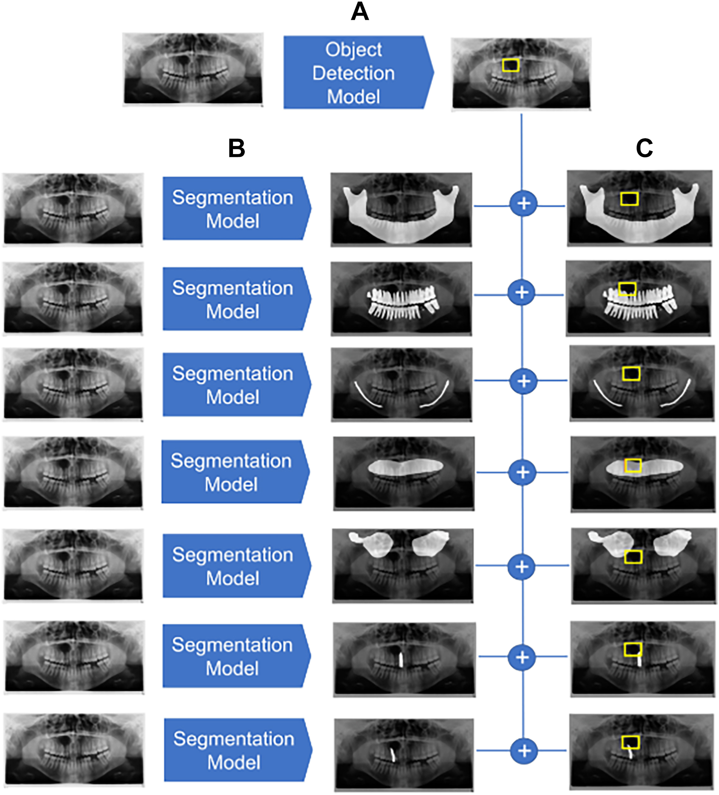 A diagram illustrates a dental image analysis workflow combining object detection of cystic lesions with anatomical segmentation to calculate overlaps between the lesion box and jaw structures.