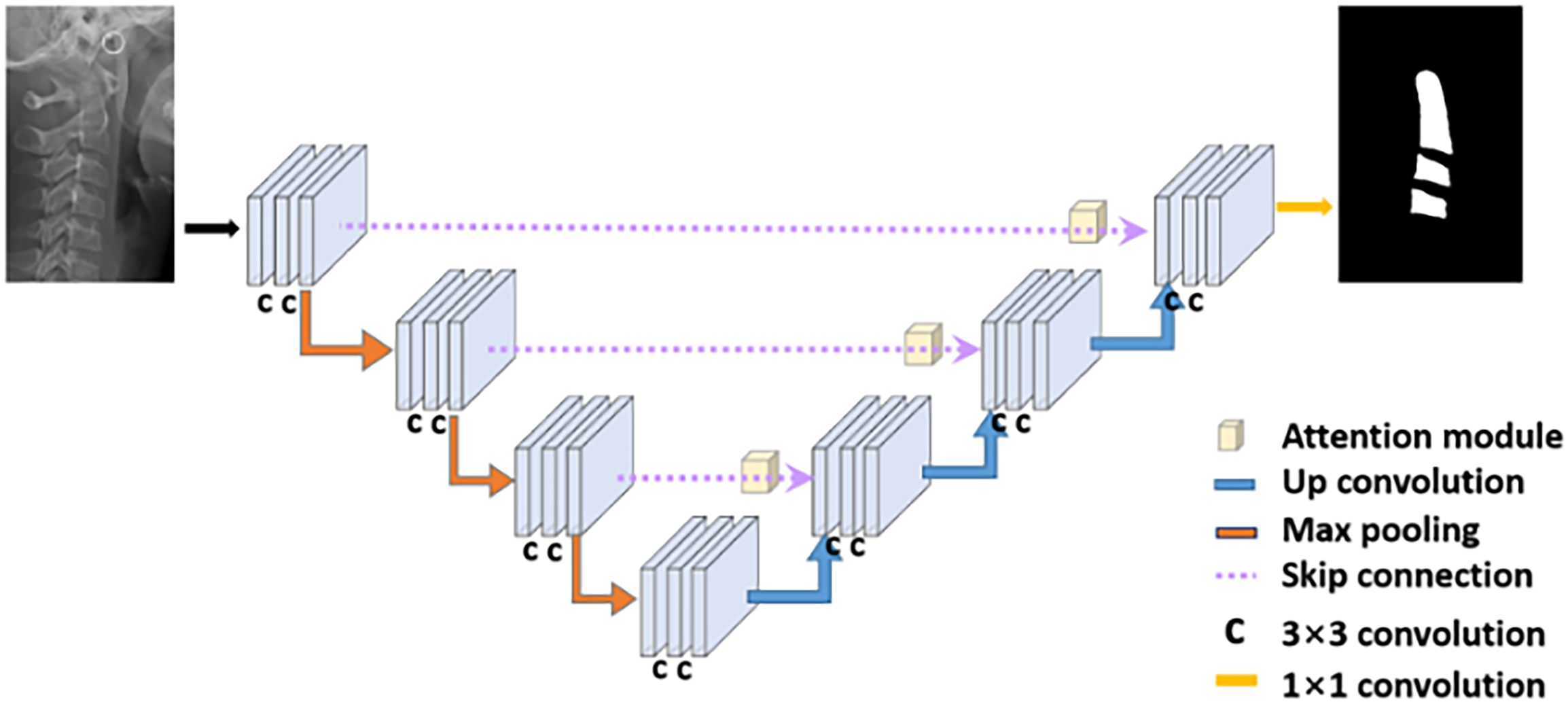 A diagram illustrates a deep learning segmentation workflow processing a cervical spine X ray through a U shaped network to output a vertebra mask.