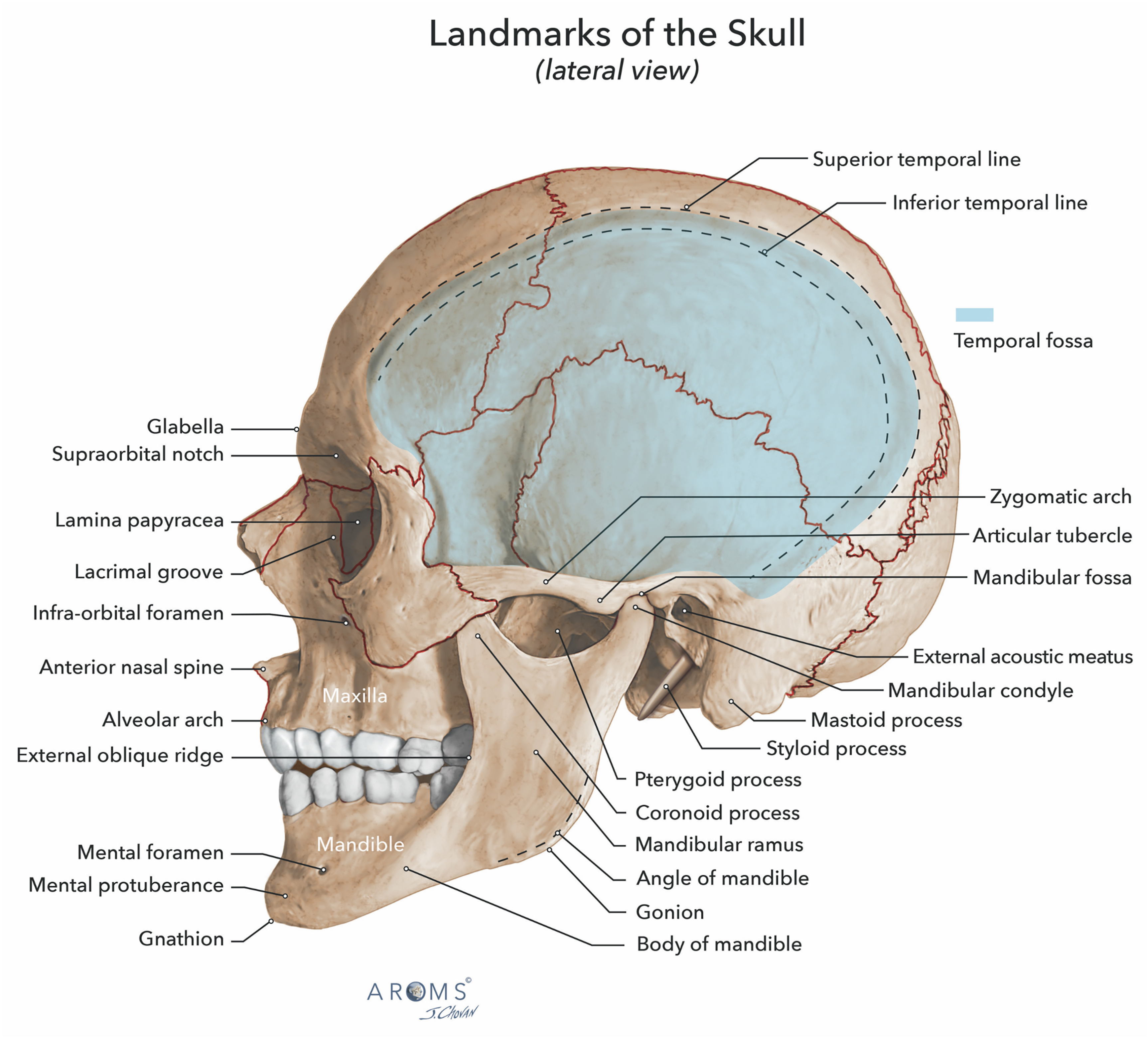 Alt text begins. An anatomical illustration of a skull in lateral view with labeled bony landmarks, including temporal lines, zygomatic arch, mandible, and facial foramina. Alt text provided by Elsevier.