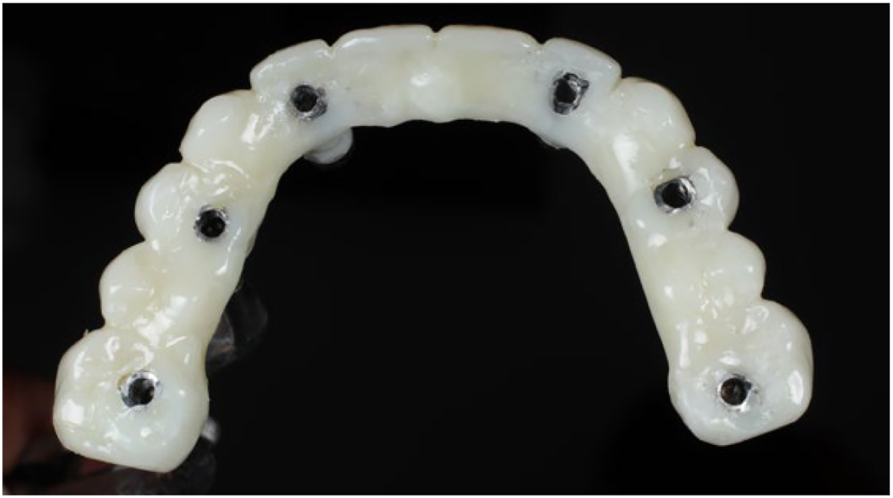 A clinical photo shows a curved dental prosthesis with six lingual access holes aligned along its length.