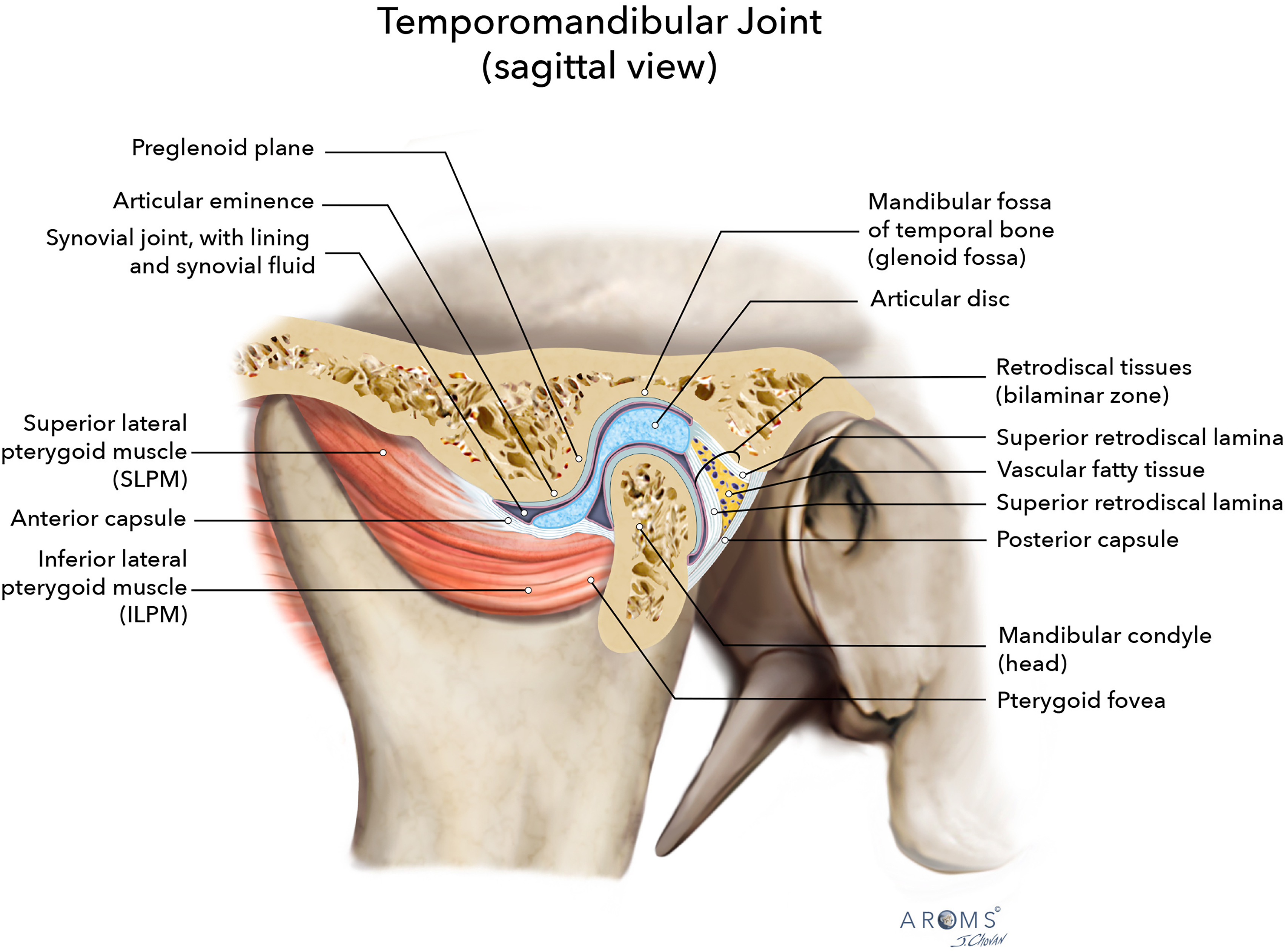 Alt text begins. An anatomical illustration of the temporomandibular joint in sagittal view with labeled soft tissue structures, articular disc, muscles, and joint components. Alt text provided by Elsevier.