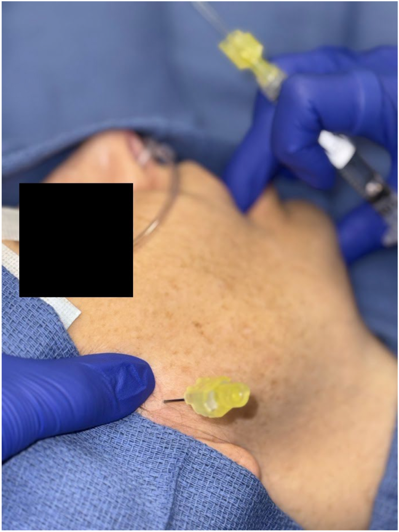 Alt text begins. A photograph depicts gloved hands manipulating the mandibular region of a draped patient, with another finger positioned near a needle inserted adjacent to the ear. Alt text provided by Elsevier.