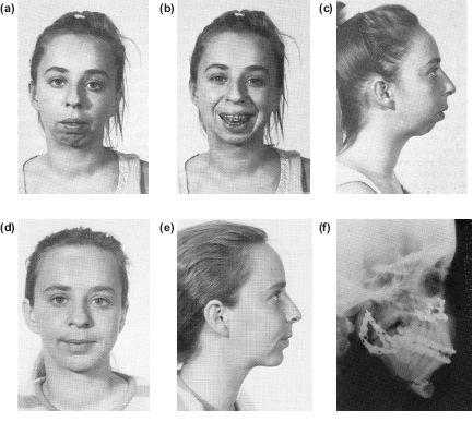 10. The Surgical Correction of Common Deformities Malcolm Harris ...