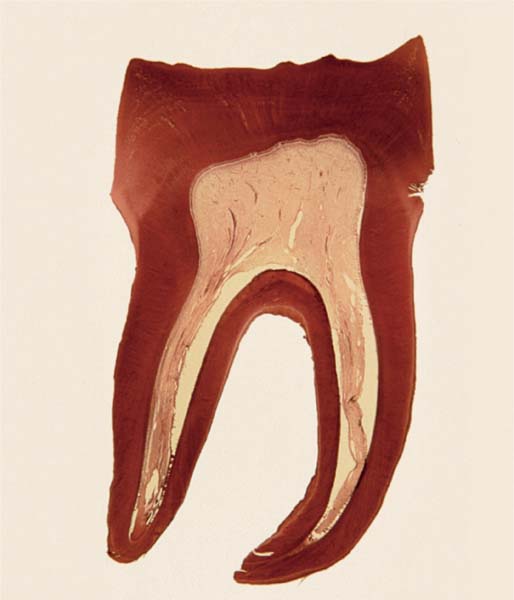 apical foramen histology