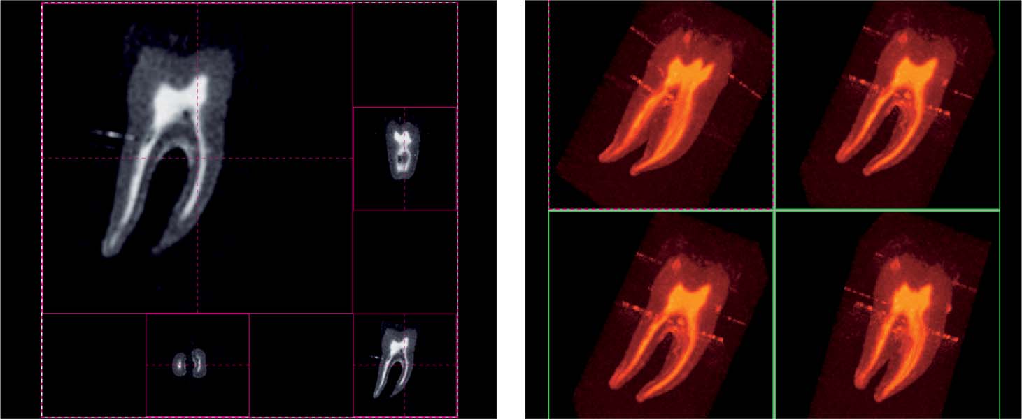 brown and herbranson 3d tooth atlas