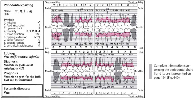 Periodontal Charting Examples