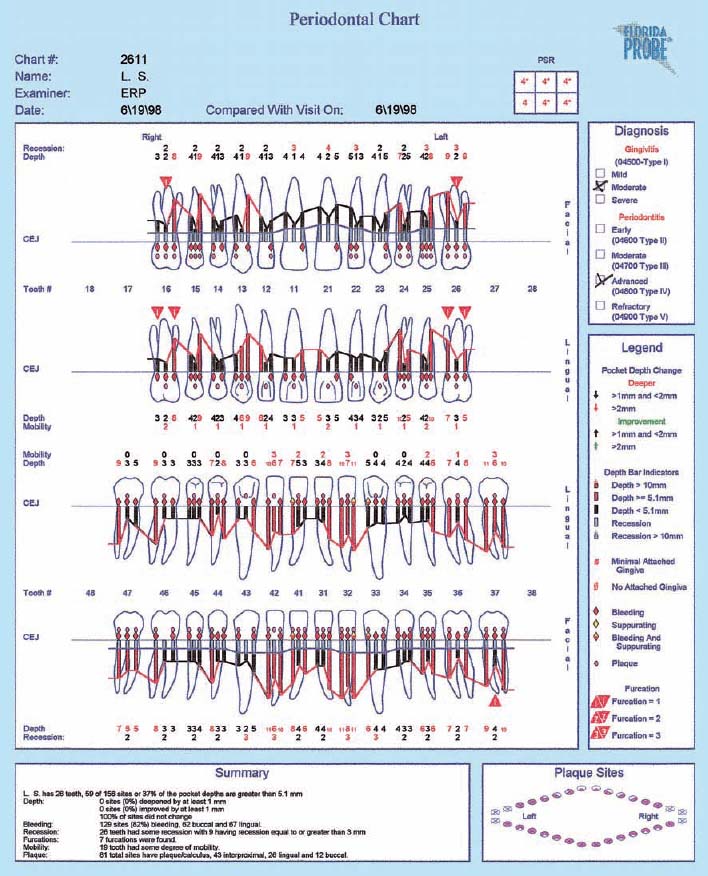 Periodontal Diagnosis Chart