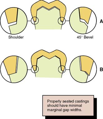 tooth preparation margin principles fit gingival teeth internal marginal pocketdentistry