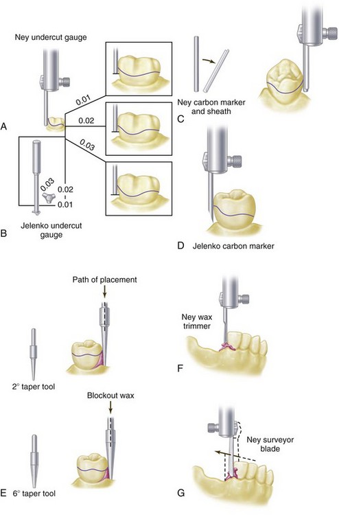 11 Surveying Pocket Dentistry