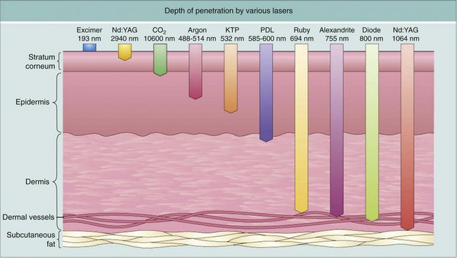 IPL safety goggles IPL safety goggles