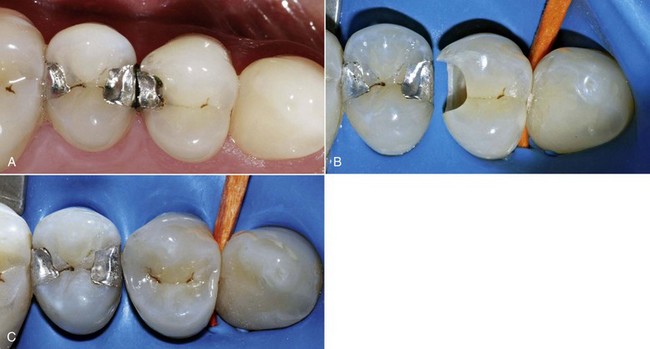 Slot Prep Dental