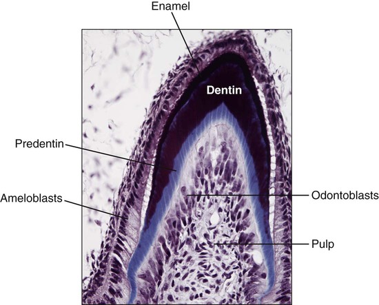 tooth pulp cavity slide