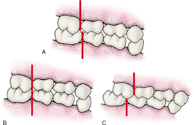 6: Occlusion | Pocket Dentistry