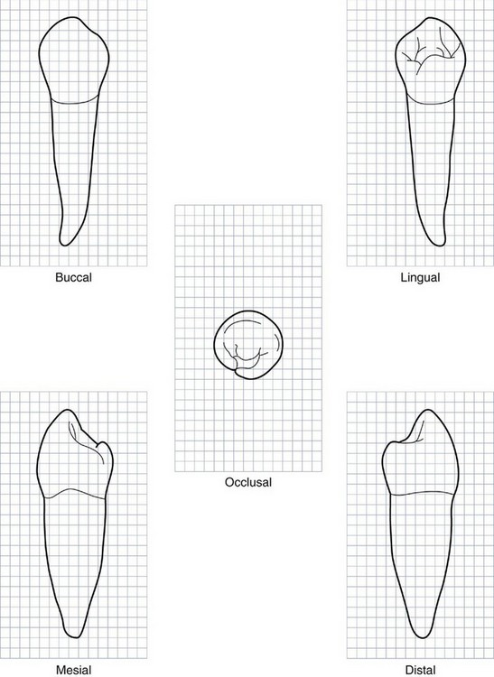 Mandibula Diagram