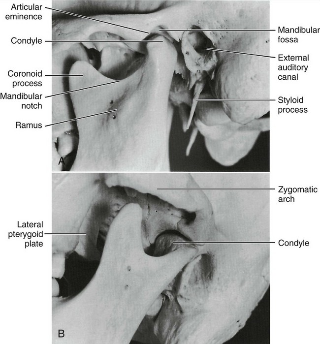 lower jaw condyle