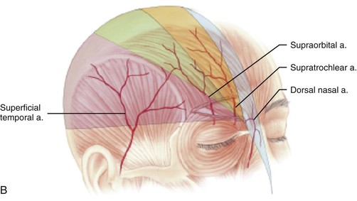 Interpolated Paramedian Forehead Flaps Pocket Dentistry
