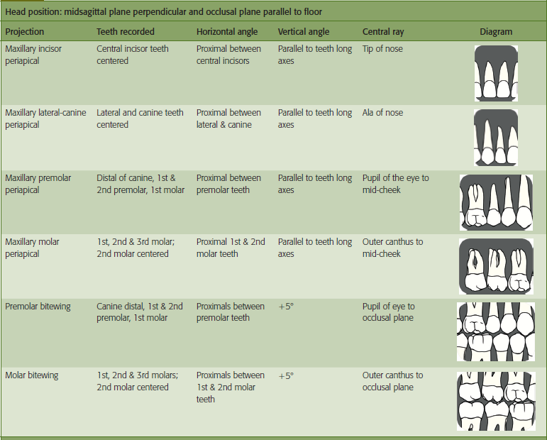 Dental Radiography Technique Chart