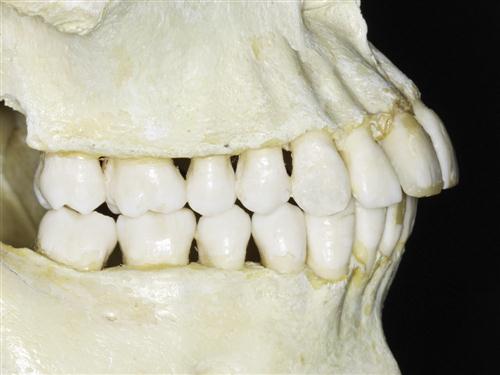 lateral view of teeth