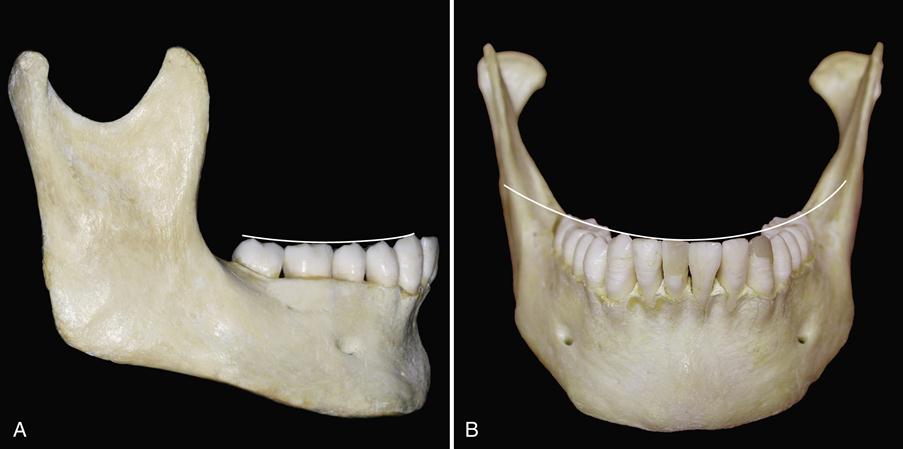 3. Alignment and Occlusion of the Dentition