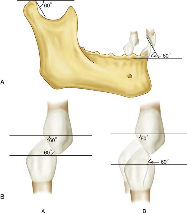 Essential requirements of a non-occlusal mandibu- lar reference position