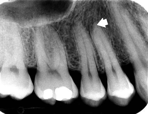 8. Intraoral Anatomy | Pocket Dentistry