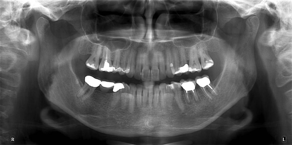 10. Panoramic Imaging | Pocket Dentistry