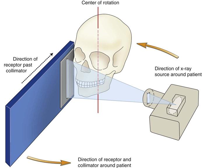 drawing of an x ray tube and collimator schematic