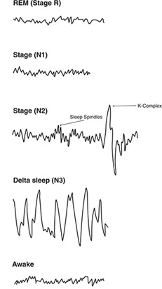 2 Human sleep | Pocket Dentistry