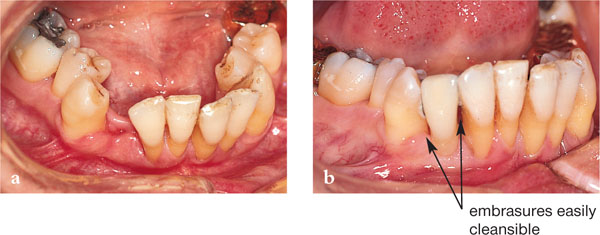 QE01_chapple_fig057b.jpg