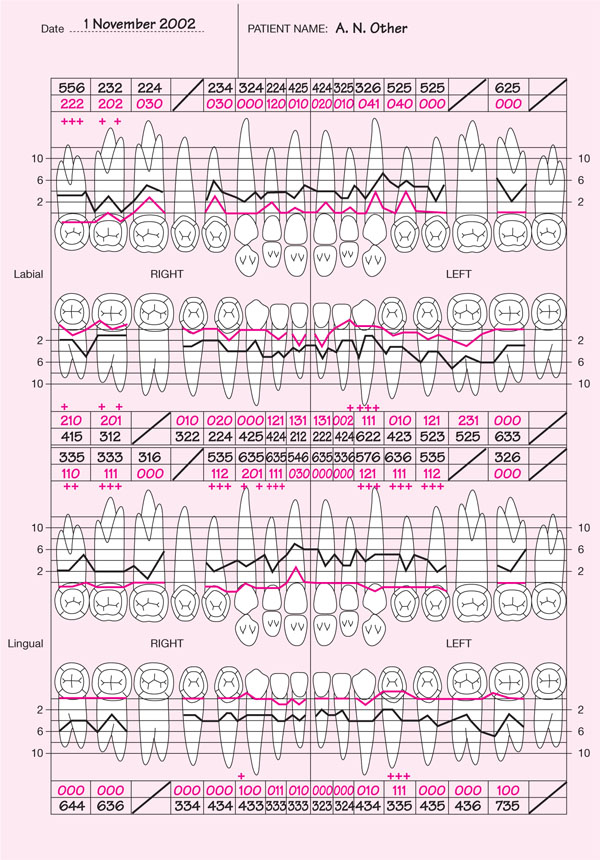 Detailed Periodontal Chart