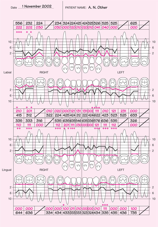 Detailed Periodontal Chart A Visual Reference of Charts Chart Master