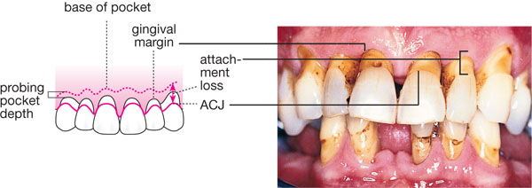 QE01_chapple_fig116b.jpg