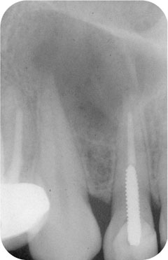 QE02_Whitworth_fig003a.jpg