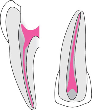 QE02_Whitworth_fig060b.jpg