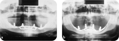 QE04_Searson_fig003.jpg