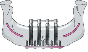 QE04_Searson_fig004a.jpg