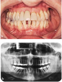 QE04_Searson_fig016.jpg