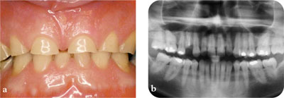 QE04_Searson_fig028.jpg