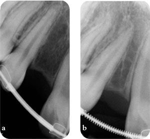 QE04_Searson_fig092b.jpg