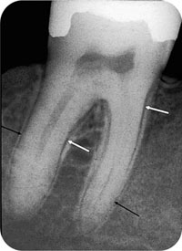 QE05_Horner_i-161_fig016b.jpg