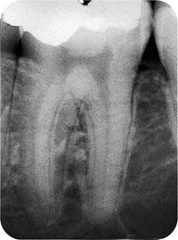 QE05_Horner_i-161_fig016c.jpg