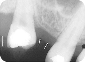 QE05_Horner_i-161_fig047.jpg