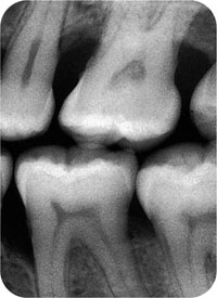 QE05_Horner_i-161_fig051b.jpg