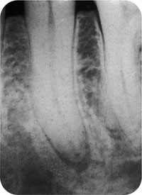 QE05_Horner_i-161_fig066c.jpg