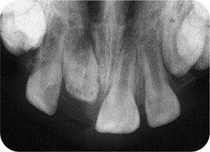 QE05_Horner_i-161_fig079.jpg