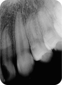 QE05_Horner_i-161_fig093.jpg