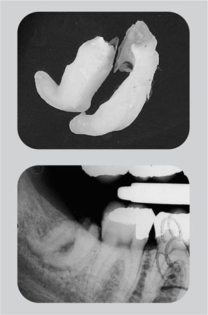 QE05_Horner_i-161_fig108.jpg