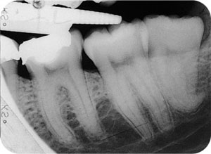 QE05_Horner_i-161_fig110b.jpg