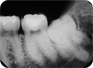 QE05_Horner_i-161_fig111a.jpg